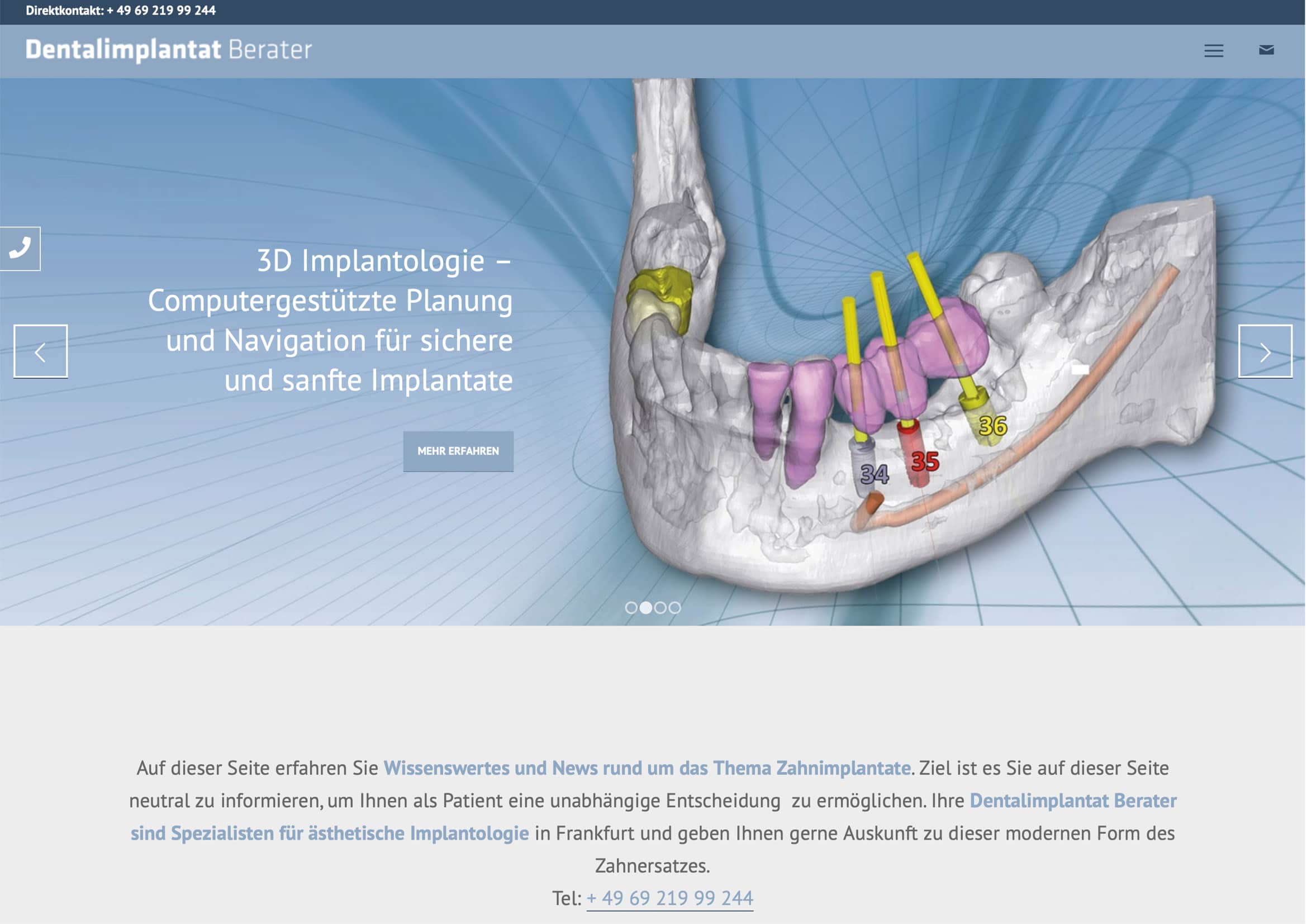 Webdesign Entwicklung für Zahnimplantat Berater Homepage Entwicklung für Implantat Berater