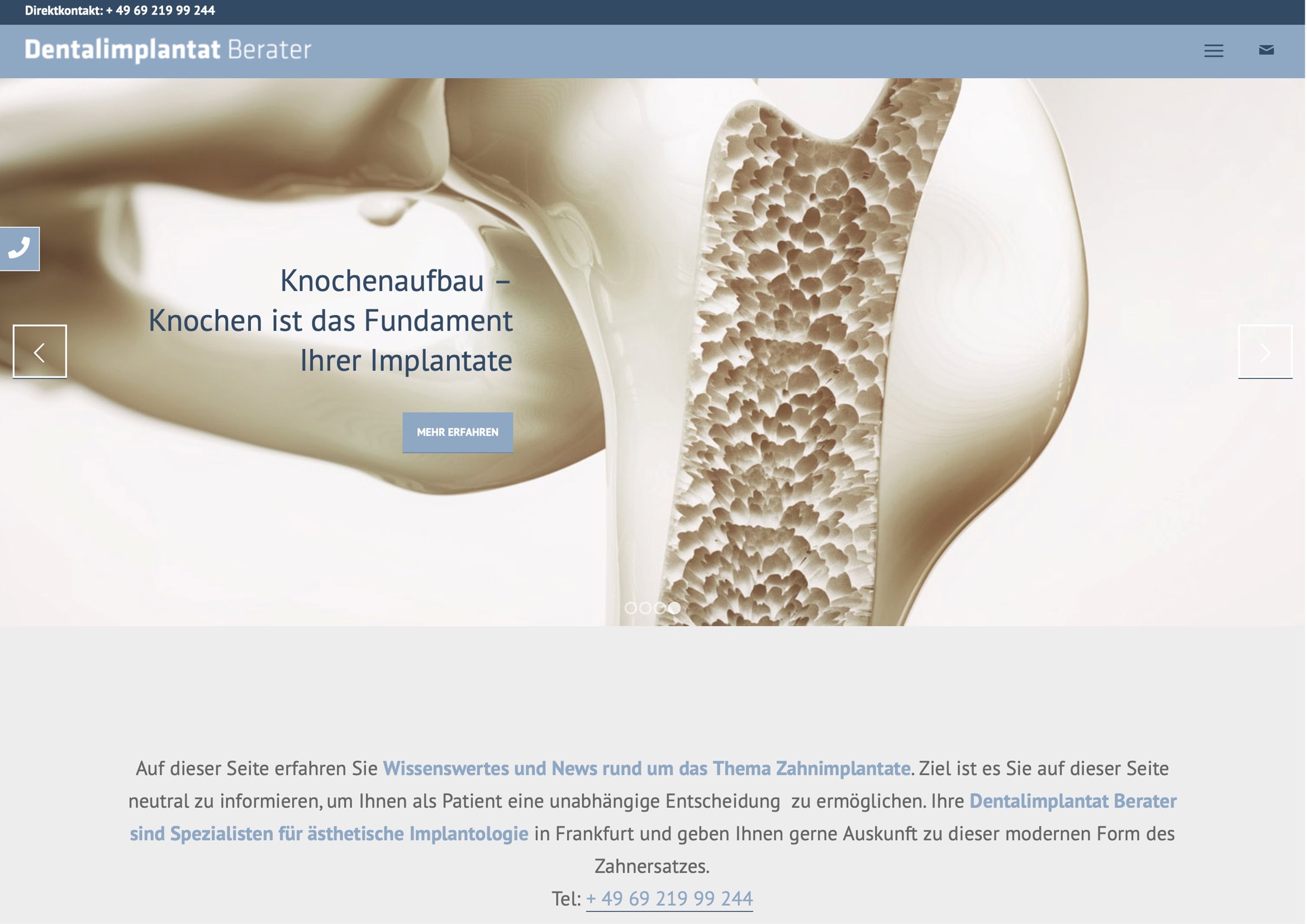 Webdesign Entwicklung für Zahnimplantat Berater Homepage Entwicklung für Zahnimplantat Berater